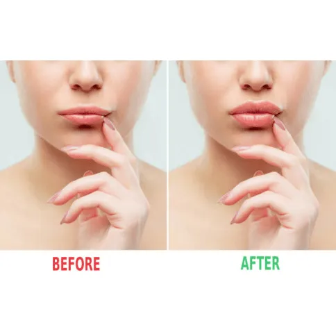 Mint Lip Plumper - MOQ 25pcs