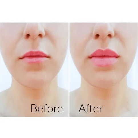 Mint Lip Plumper - MOQ 25pcs