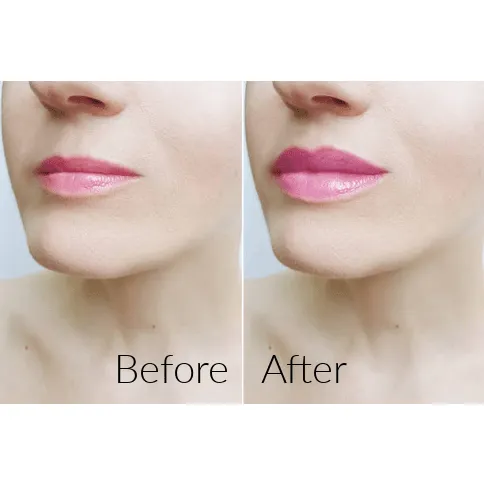 Mint Lip Plumper - MOQ 25pcs